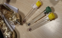 Sarp Sınır Kapısı'nda Tehlike !